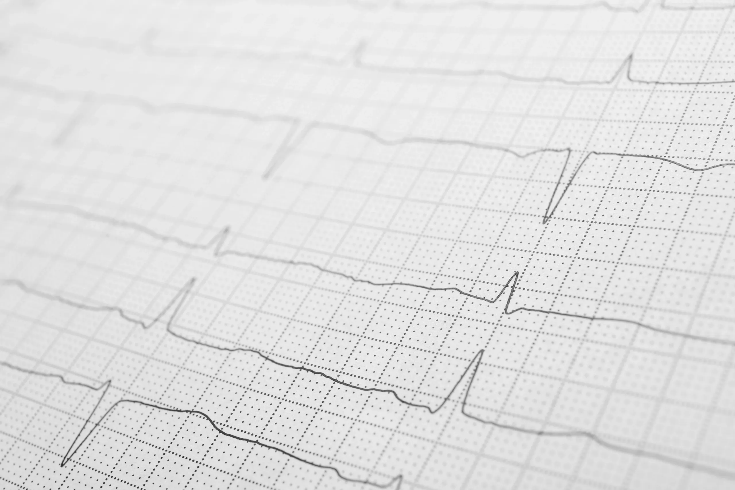 Resultado de prueba médica solicitada por hipocondríaco antes de mejorar con su tratamiento psicológico en Granada